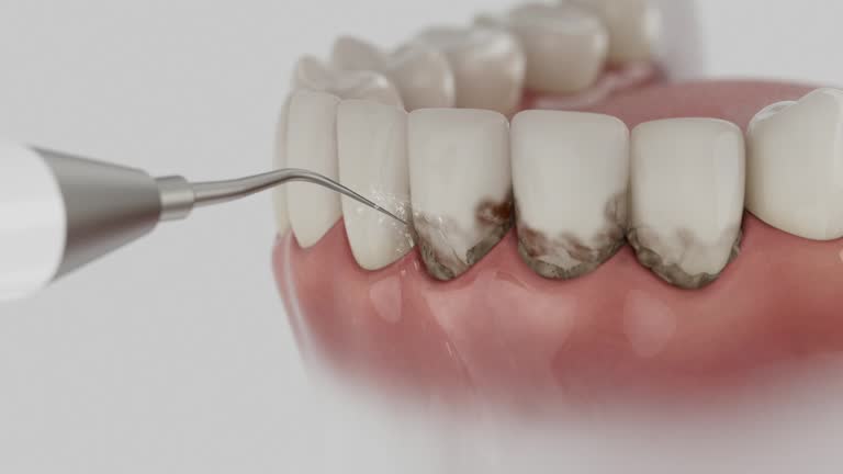 Trusted Tooth Extraction service in Rogersville, TN - Dentist Open Now